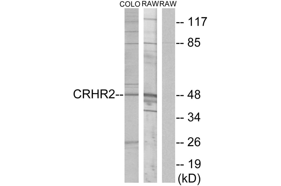 Western Blot - Anti-CRHR2 Antibody (G073) - Antibodies.com