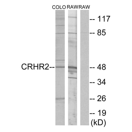 Western Blot - Anti-CRHR2 Antibody (G073) - Antibodies.com