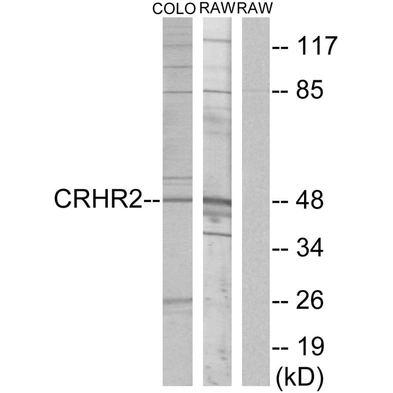 Western Blot - Anti-CRHR2 Antibody (G073) - Antibodies.com