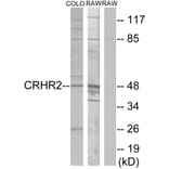 Western Blot - Anti-CRHR2 Antibody (G073) - Antibodies.com