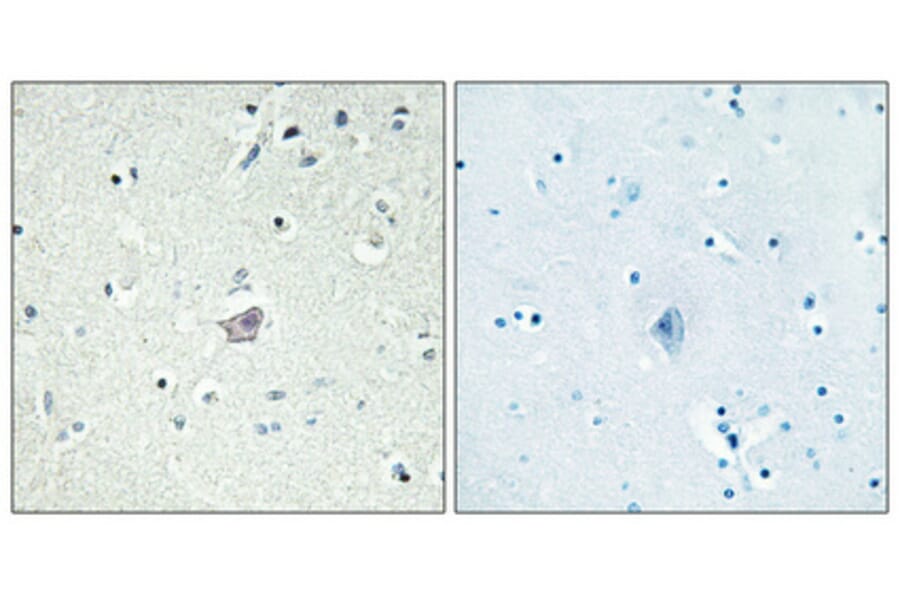 Immunohistochemistry - Anti-CRHR2 Antibody (G073) - Antibodies.com