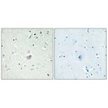 Immunohistochemistry - Anti-CRHR2 Antibody (G073) - Antibodies.com