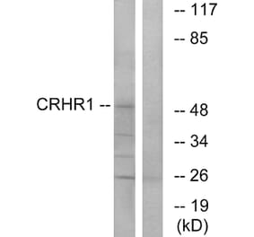 Western Blot - Anti-CRHR1 Antibody (G072) - Antibodies.com