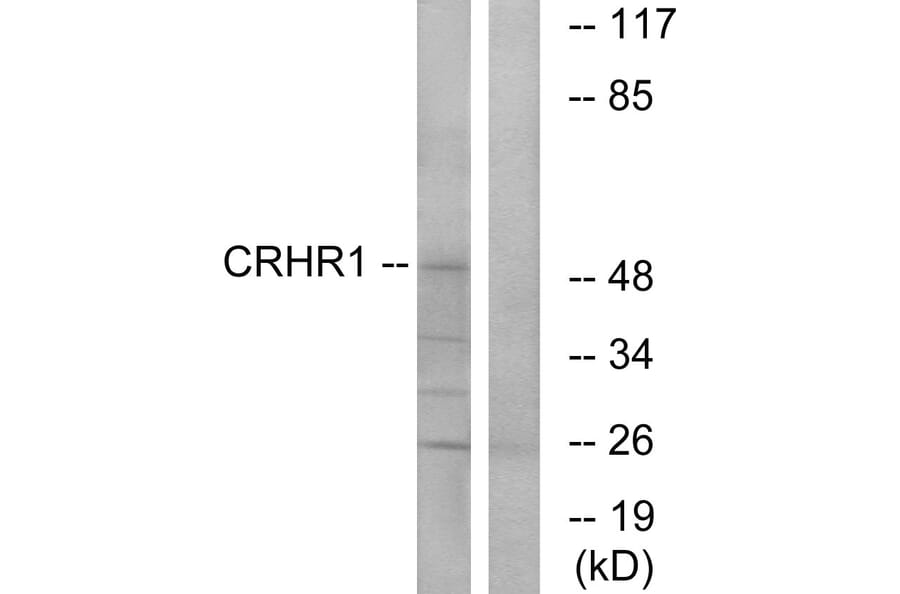 Western Blot - Anti-CRHR1 Antibody (G072) - Antibodies.com