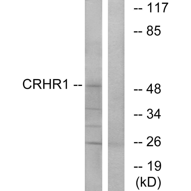 Western Blot - Anti-CRHR1 Antibody (G072) - Antibodies.com