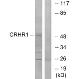 Western Blot - Anti-CRHR1 Antibody (G072) - Antibodies.com