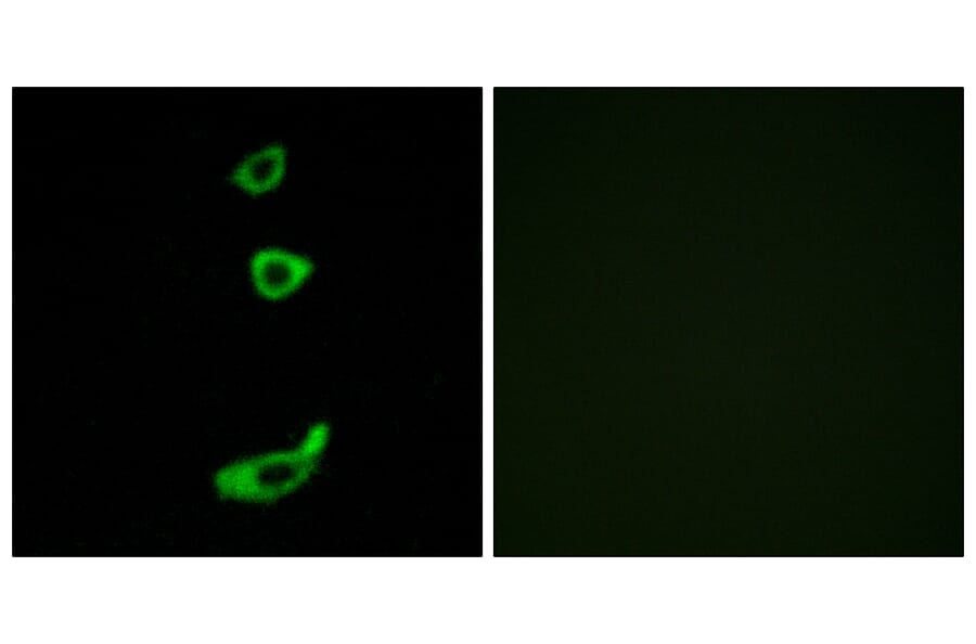 Immunofluorescence - Anti-CRHR1 Antibody (G072) - Antibodies.com