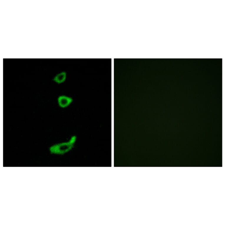 Immunofluorescence - Anti-CRHR1 Antibody (G072) - Antibodies.com
