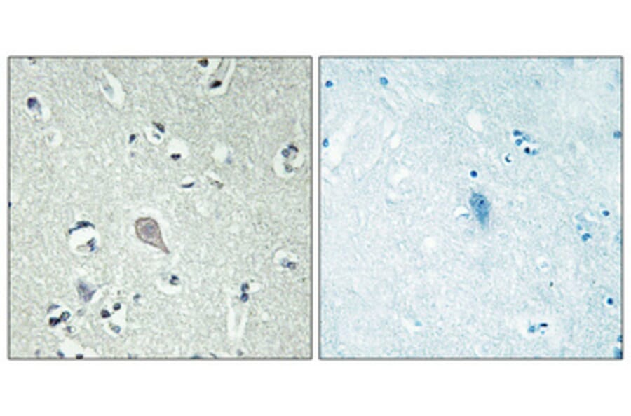 Immunohistochemistry - Anti-CRHR1 Antibody (G072) - Antibodies.com