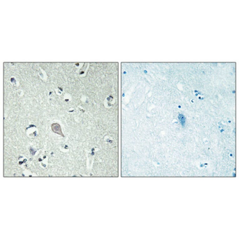 Immunohistochemistry - Anti-CRHR1 Antibody (G072) - Antibodies.com
