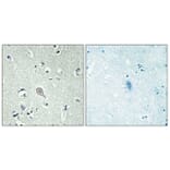 Immunohistochemistry - Anti-CRHR1 Antibody (G072) - Antibodies.com