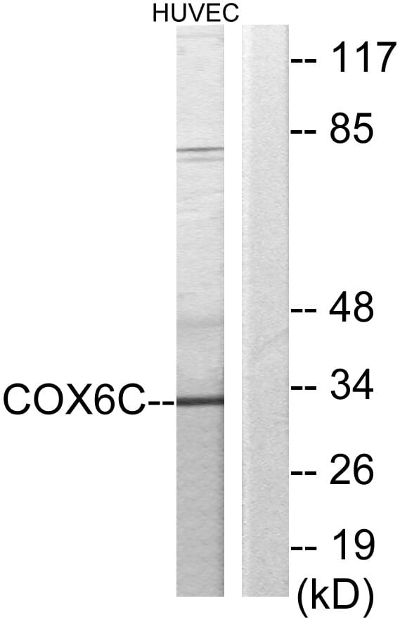 Western blot analysis of lysates from HUVEC cells using Anti-COX6C Antibody. The right hand lane represents a negative control, where the antibody is blocked by the immunising peptide.