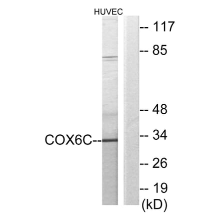 Western Blot - Anti-COX6C Antibody (C12239) - Antibodies.com