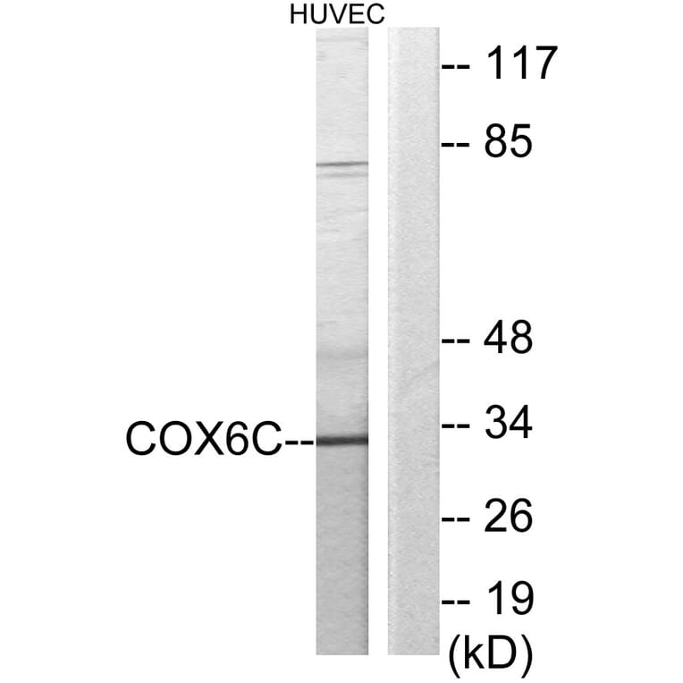 Western Blot - Anti-COX6C Antibody (C12239) - Antibodies.com