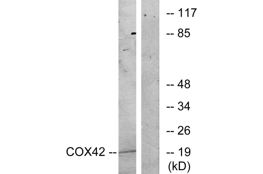 Western Blot - Anti-COX42 Antibody (C12236) - Antibodies.com