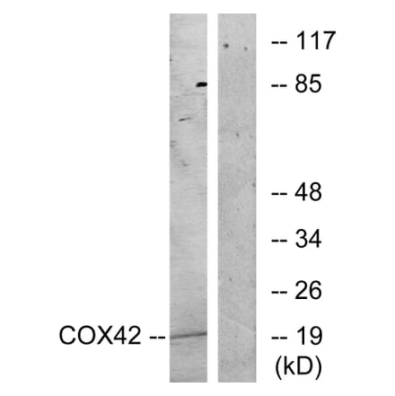 Western Blot - Anti-COX42 Antibody (C12236) - Antibodies.com