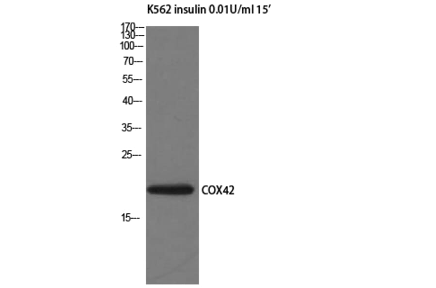 Western Blot - Anti-COX42 Antibody (C12236) - Antibodies.com