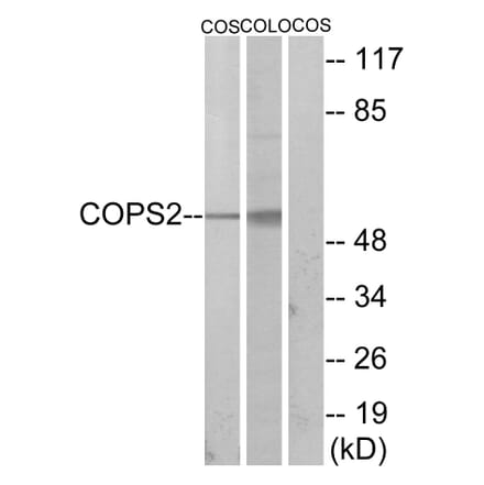 Western Blot - Anti-COPS2 Antibody (C10768) - Antibodies.com
