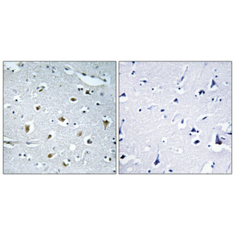 Immunohistochemistry - Anti-COPS2 Antibody (C10768) - Antibodies.com