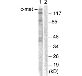 Western Blot - Anti-c-Met Antibody (B0871) - Antibodies.com