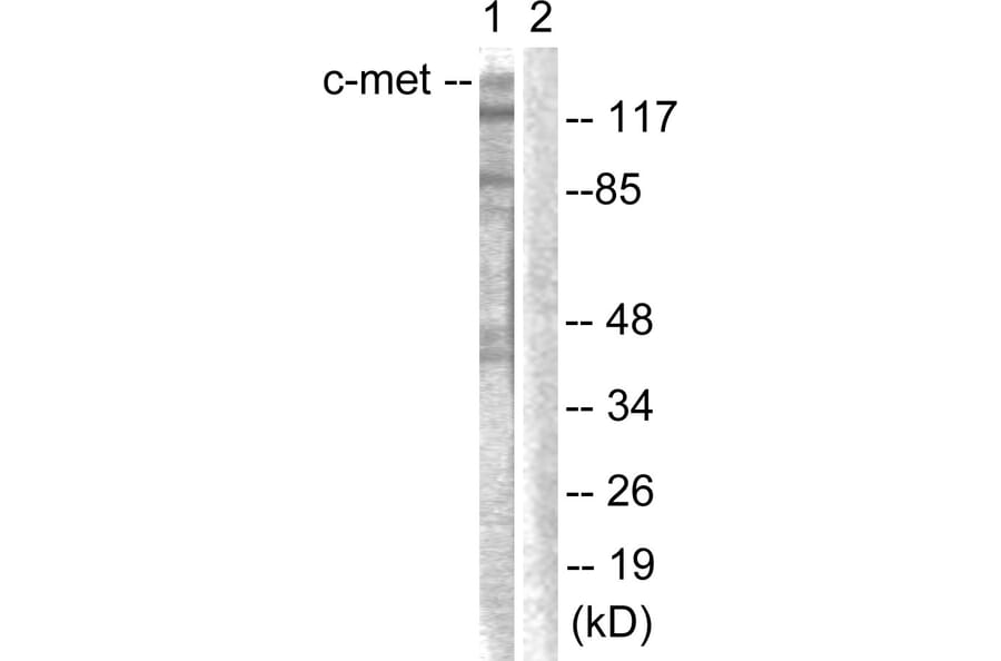 Western Blot - Anti-c-Met Antibody (B0871) - Antibodies.com