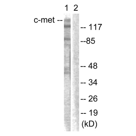 Western Blot - Anti-c-Met Antibody (B0871) - Antibodies.com