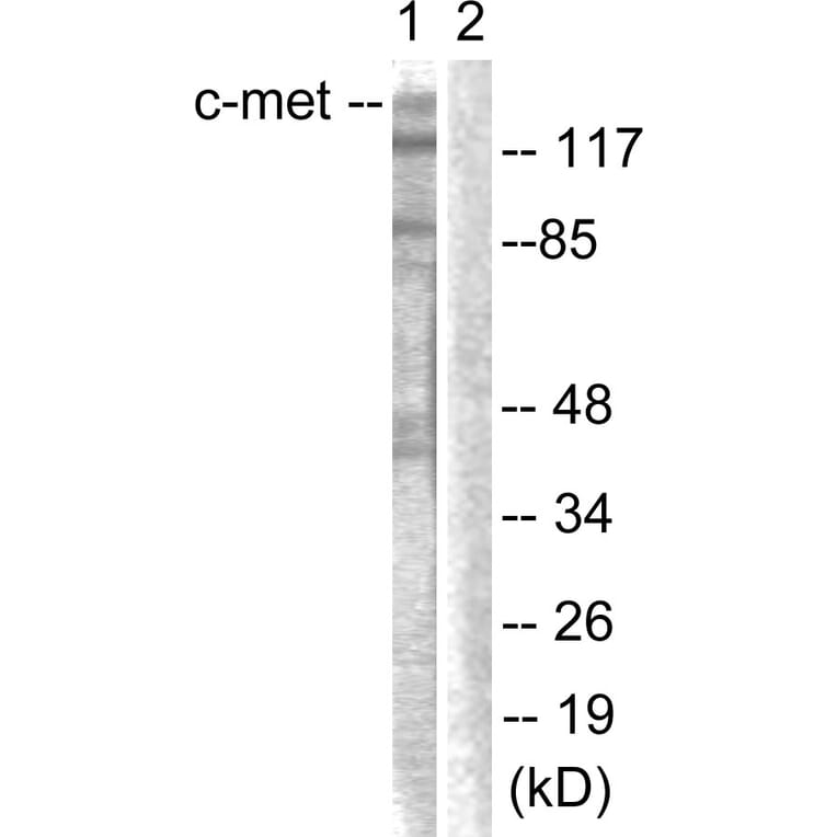 Western Blot - Anti-c-Met Antibody (B0871) - Antibodies.com