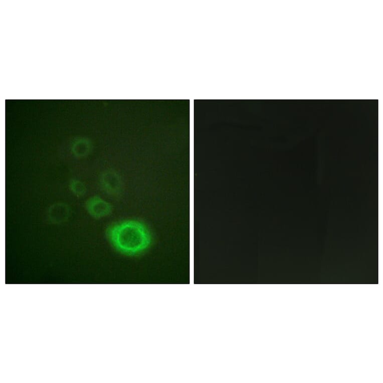 Immunofluorescence - Anti-c-Met Antibody (B0871) - Antibodies.com