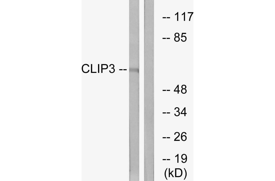 Western Blot - Anti-CLIP3 Antibody (C14917) - Antibodies.com