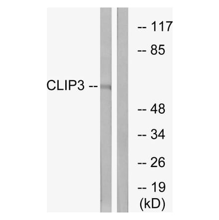 Western Blot - Anti-CLIP3 Antibody (C14917) - Antibodies.com