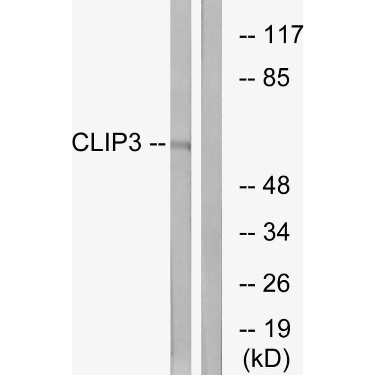 Western Blot - Anti-CLIP3 Antibody (C14917) - Antibodies.com