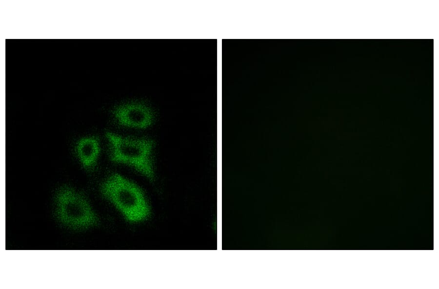 Immunofluorescence - Anti-CLIP3 Antibody (C14917) - Antibodies.com