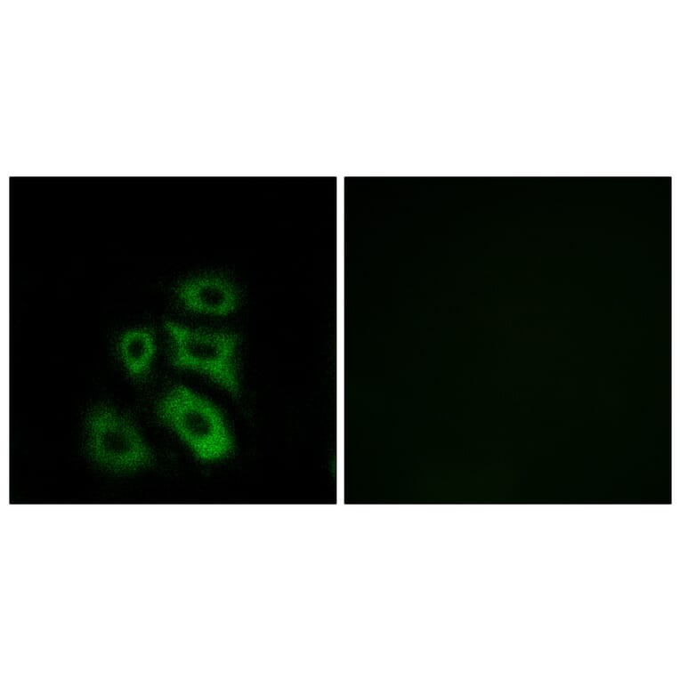 Immunofluorescence - Anti-CLIP3 Antibody (C14917) - Antibodies.com