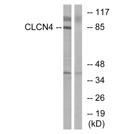 Western Blot - Anti-CLCN4 Antibody (C15079) - Antibodies.com