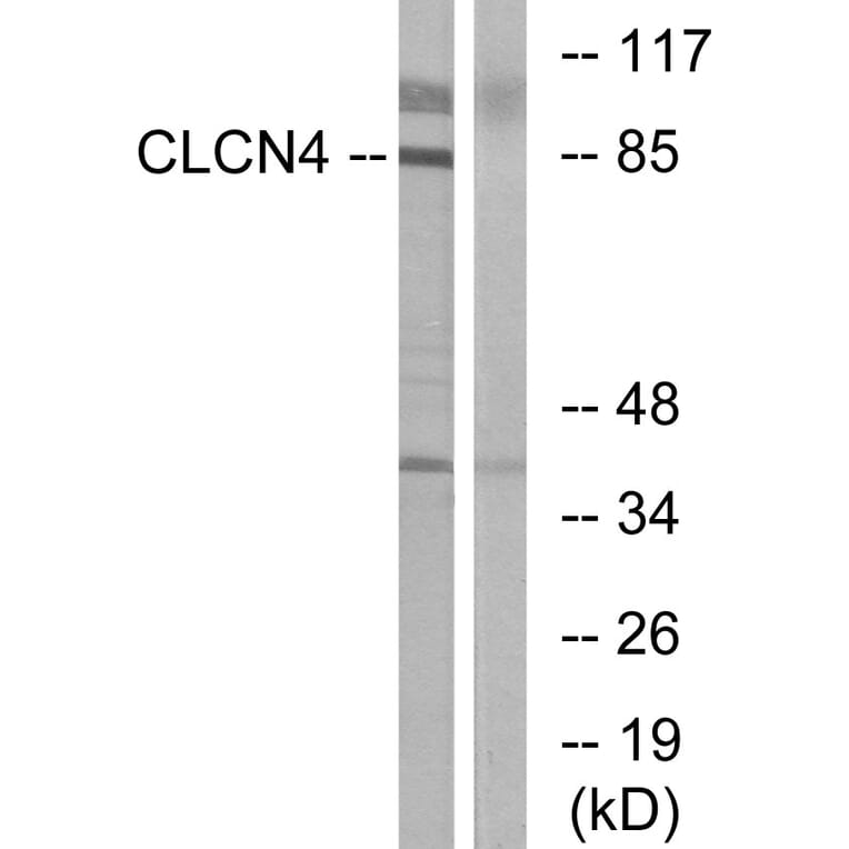 Western Blot - Anti-CLCN4 Antibody (C15079) - Antibodies.com