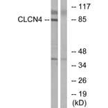 Western Blot - Anti-CLCN4 Antibody (C15079) - Antibodies.com