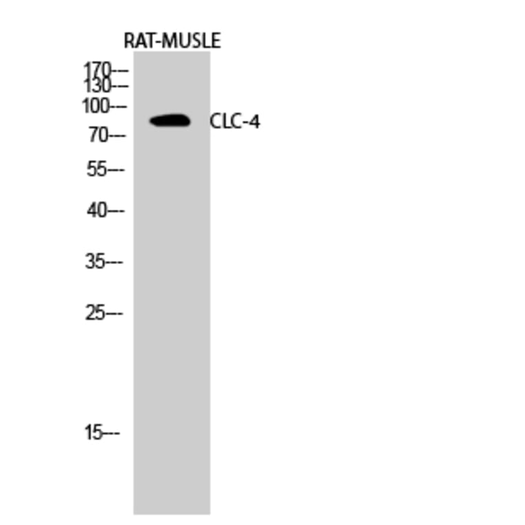 Western Blot - Anti-CLCN4 Antibody (C15079) - Antibodies.com