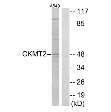 Western Blot - Anti-CKMT2 Antibody (C10407) - Antibodies.com