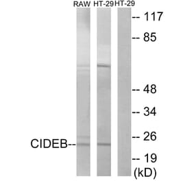 Western Blot - Anti-CIDEB Antibody (C13034) - Antibodies.com