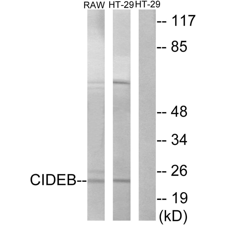 Western Blot - Anti-CIDEB Antibody (C13034) - Antibodies.com