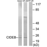 Western Blot - Anti-CIDEB Antibody (C13034) - Antibodies.com