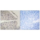 Immunohistochemistry - Anti-CIDEB Antibody (C13034) - Antibodies.com