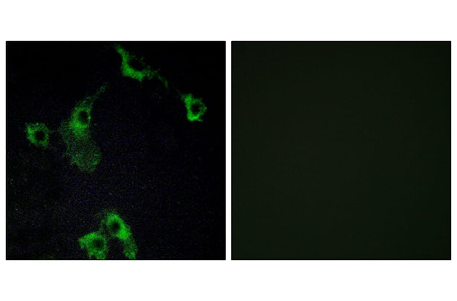 Immunofluorescence - Anti-CIDEB Antibody (C13034) - Antibodies.com