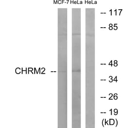 Western Blot - Anti-CHRM2 Antibody (G206) - Antibodies.com