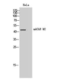 Western Blot - Anti-CHRM2 Antibody (G206) - Antibodies.com