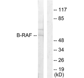 Western Blot - Anti-B-RAF Antibody (C10378) - Antibodies.com