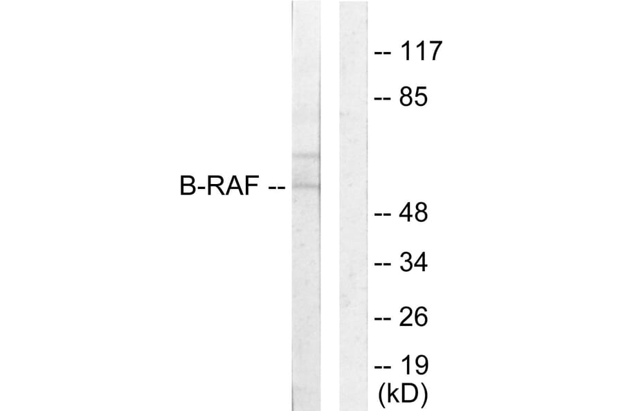 Western Blot - Anti-B-RAF Antibody (C10378) - Antibodies.com