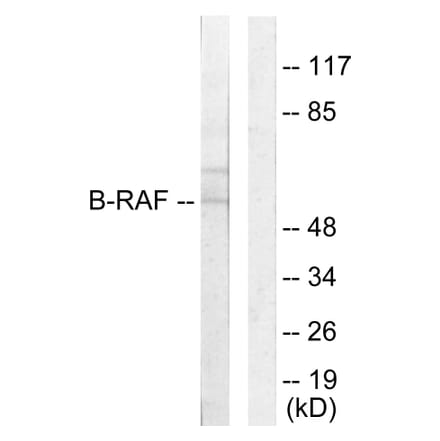 Western Blot - Anti-B-RAF Antibody (C10378) - Antibodies.com