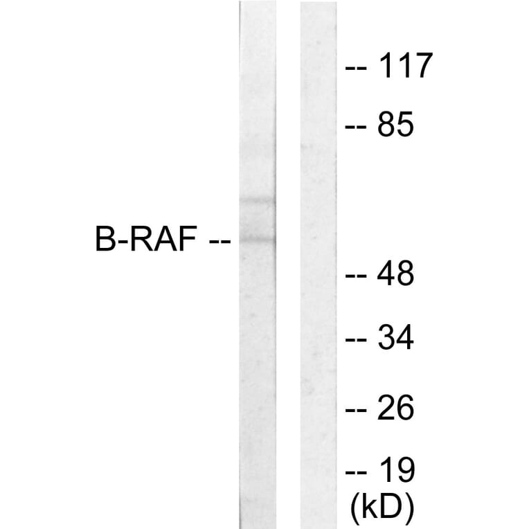 Western Blot - Anti-B-RAF Antibody (C10378) - Antibodies.com