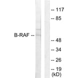 Western Blot - Anti-B-RAF Antibody (C10378) - Antibodies.com